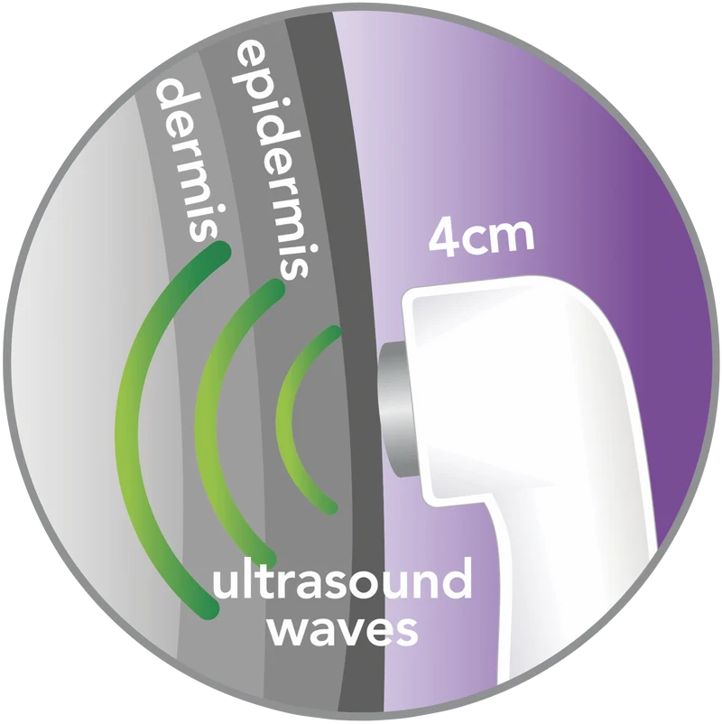 REVITIVE Ultrasound Therapy