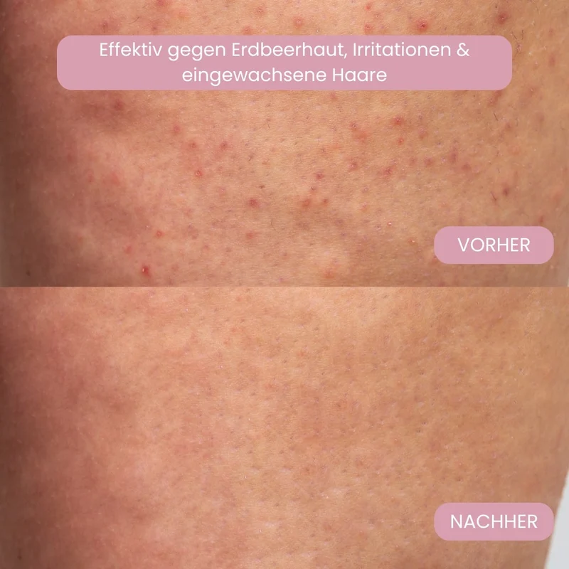 Trådløs elektrisk intimtrimmer til kvinder | 2-i-1 bikini barbermaskine til våd og tør brug | USB genopladelig, vandtæt
