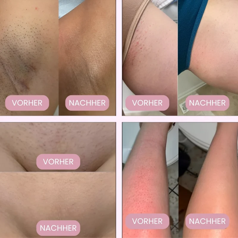 Trådløs elektrisk intimtrimmer til kvinder | 2-i-1 bikini barbermaskine til våd og tør brug | USB genopladelig, vandtæt