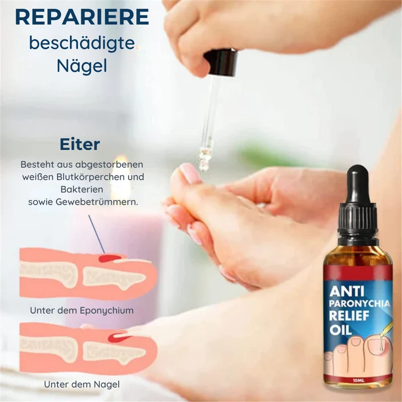 Negle- og neglebåndolie 10 ml | Trænger hurtigt ind på 30 sek. | Plejer irriterede neglekant og misfarvede negle | Naturlig