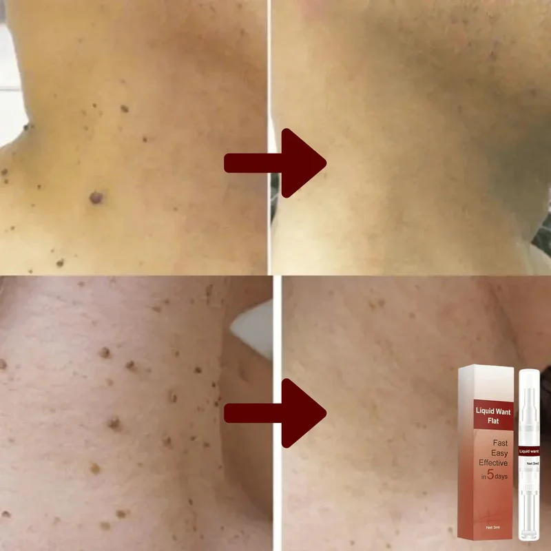 Hautserum med Te-træolie og urtekstrakter, 3 ml – Til ansigt og krop