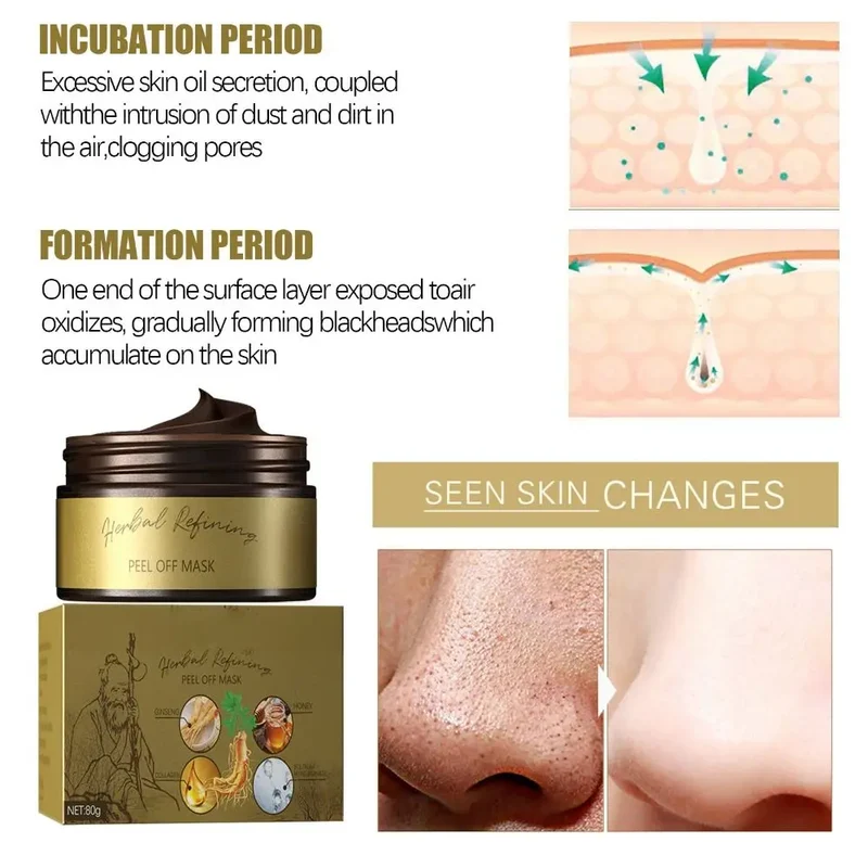 Sort Te Ansigt Peel-off Maske