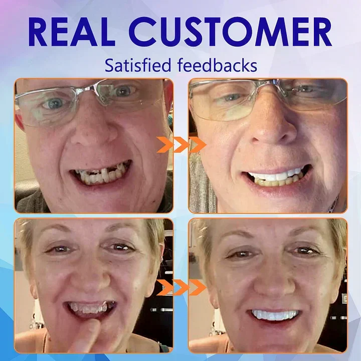 SmileFitPro – Ny Generation: Fleksibel Helprotese