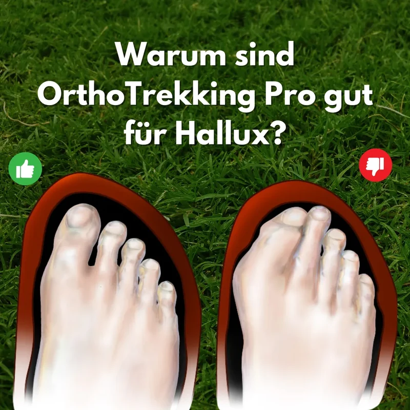 Ergonomiske Trekking- og Vandresko til Hallux Valgus