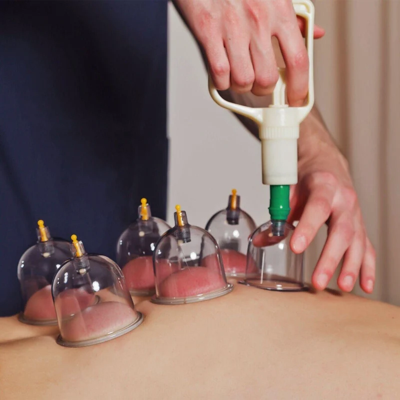 32 Deles Sæt til Massage og Akupunktur med Sugeterapi