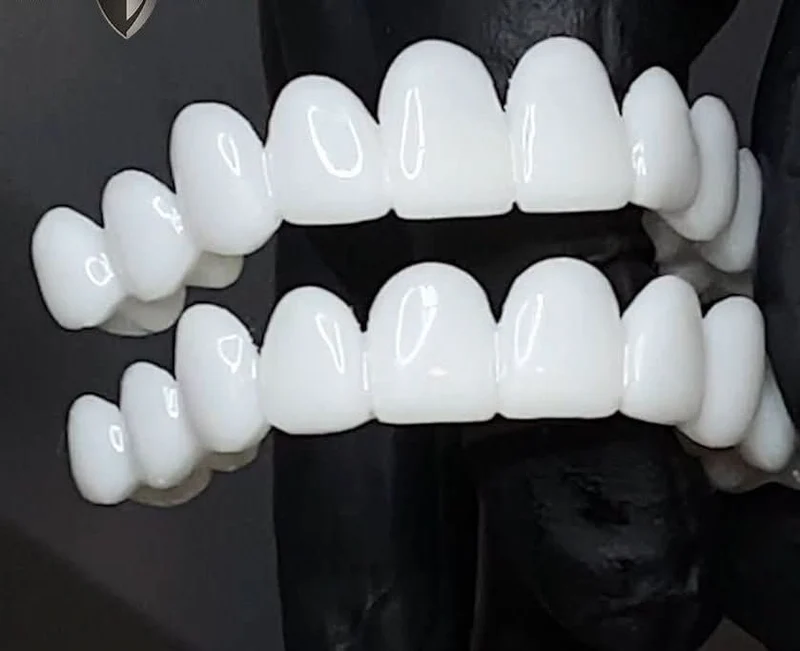SmileEase – Lettere tandproteser til en strålende smil