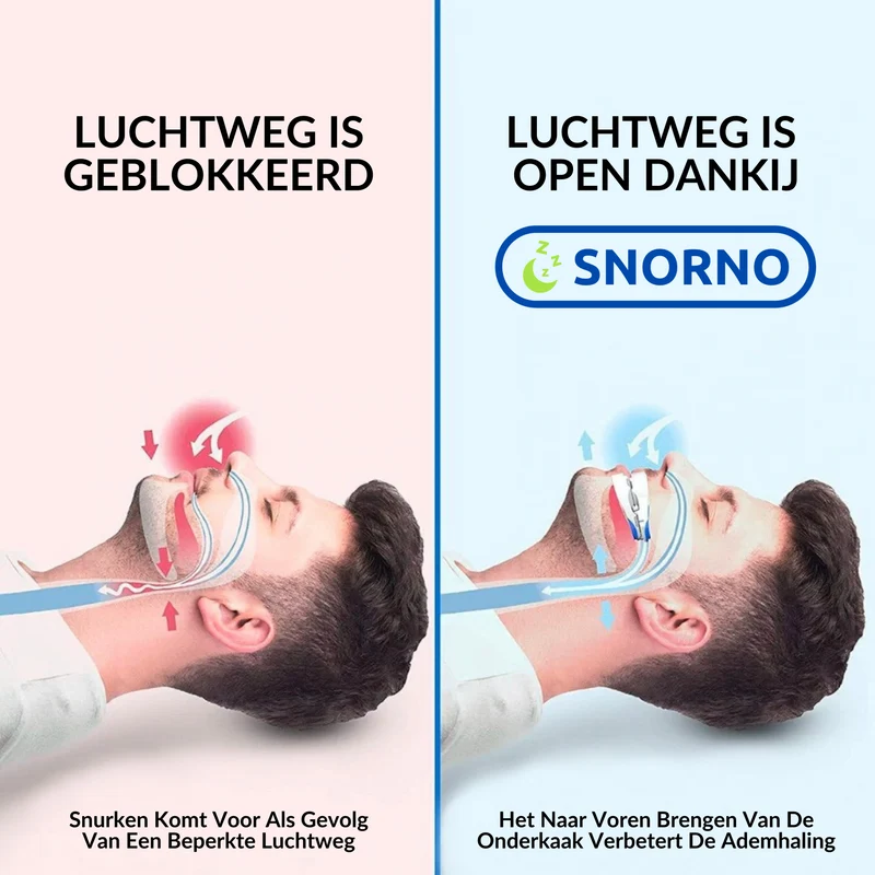 Søvnvenlig Beugel til Ronkefri Nætter