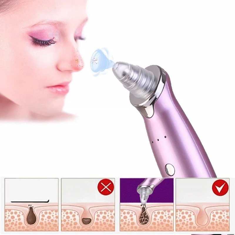 Elektrisk Ansigtspore Renser til Acne og Blackheads