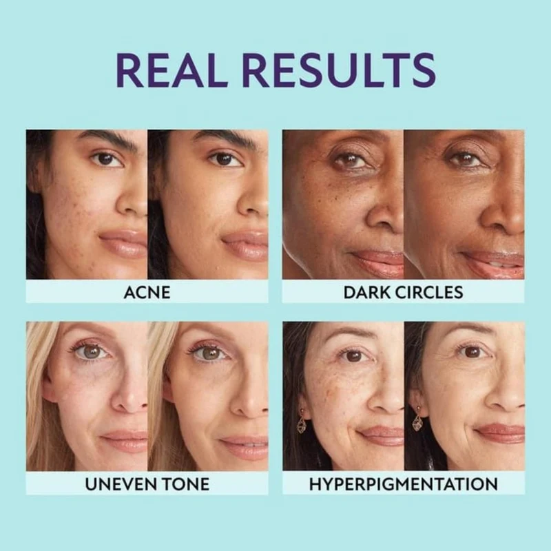 Fugtende Concealer med Naturlig Dækning og Lang Holdbarhed