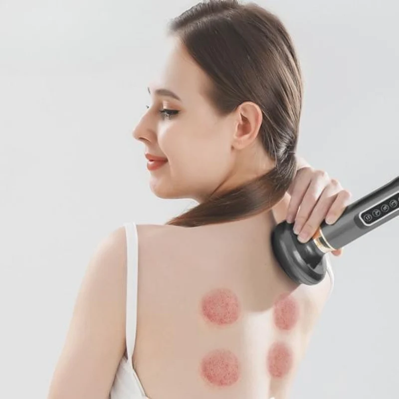 Effektiv Elektrisk Kupping Massager til Hurtig Muskelrecovery