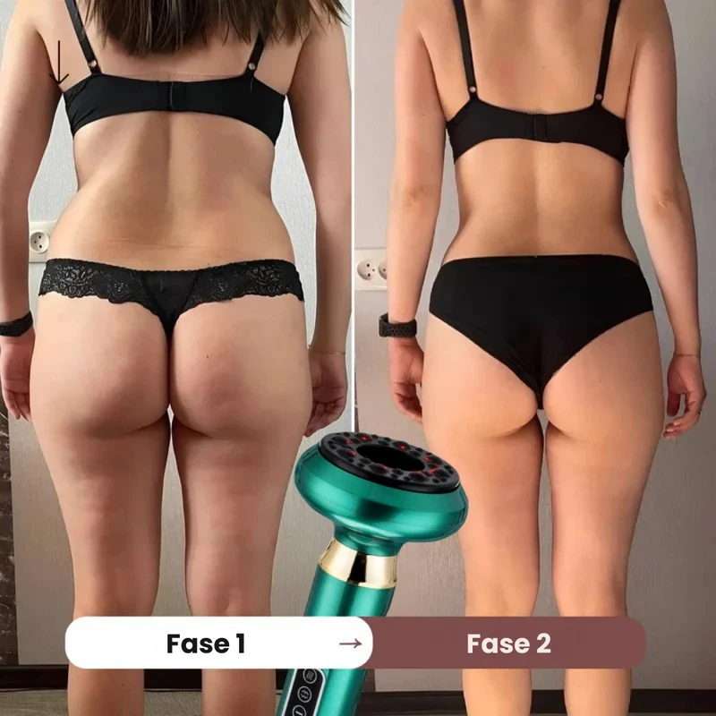 Effektiv Anti-Cellulite Massager – Glat og Stram Hud Hjemme