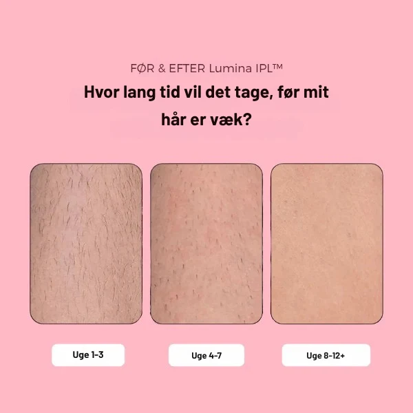 Effektiv IPL Hårfjerning derhjemme | Smertefri & Langvarig